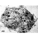 Macrophage observé au microscope électronique à transmission