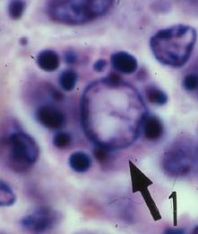 macrophage