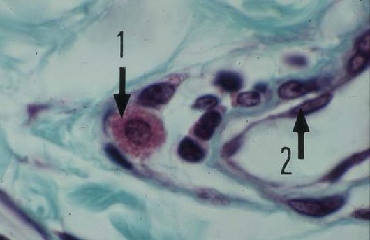 mastocyte